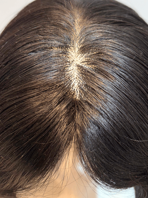 Luxury Silk Top Human Hair Wig – Most Natural Scalp Look-4